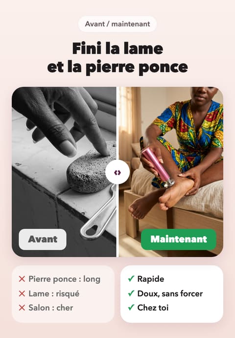 Fini la lame et la pierre ponce. Avant : pierre ponce longue, lame risquée, salon cher. Maintenant : rapide, doux, sans forcer, chez toi.